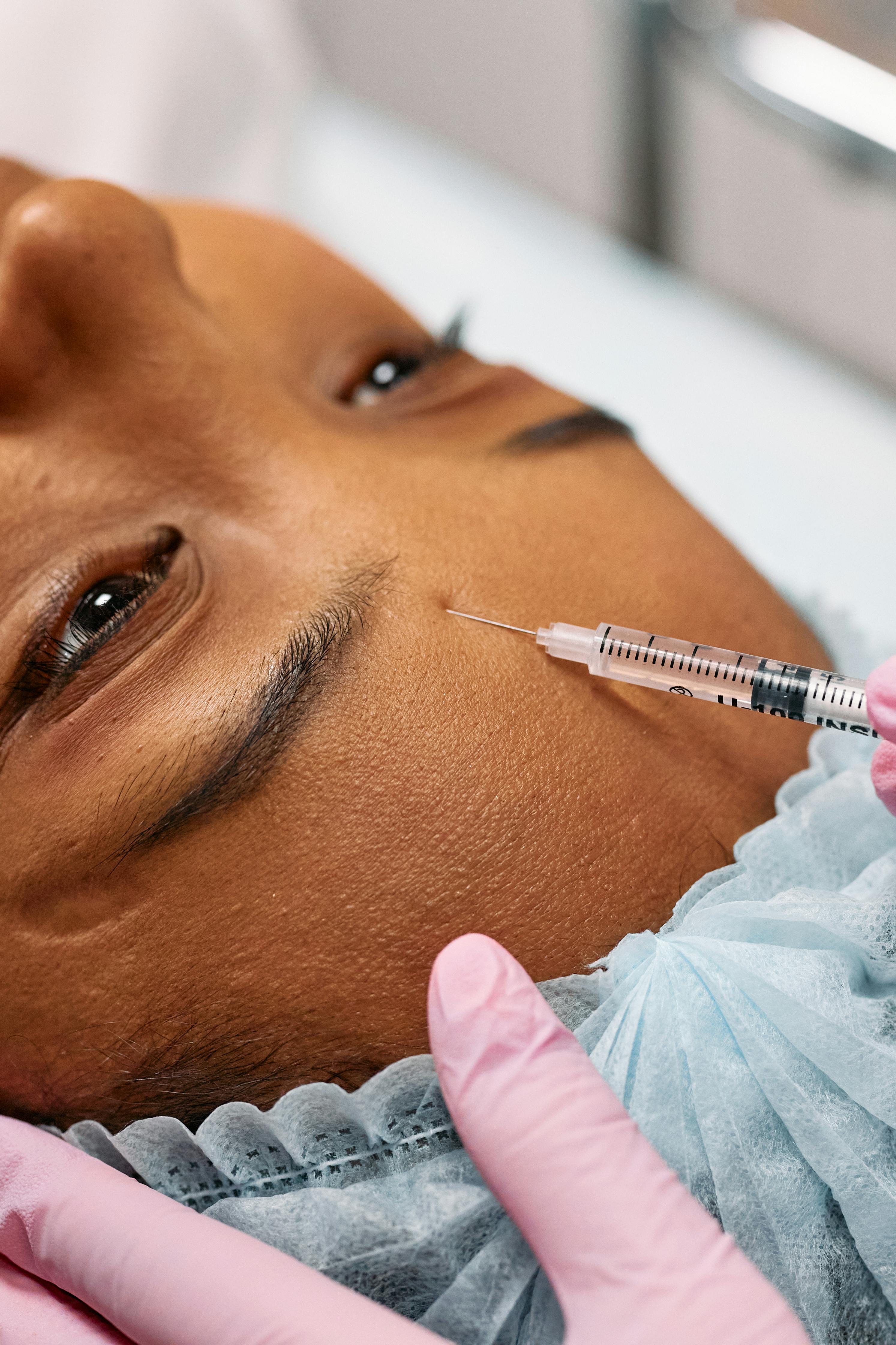 Tratamento de Bioestimuladores Faciais