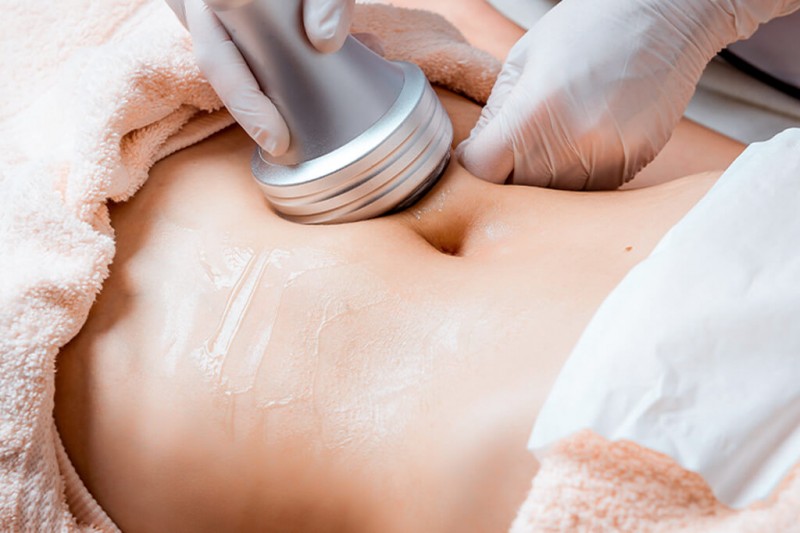 Sessão de Cavitação em FG Estética Avançada