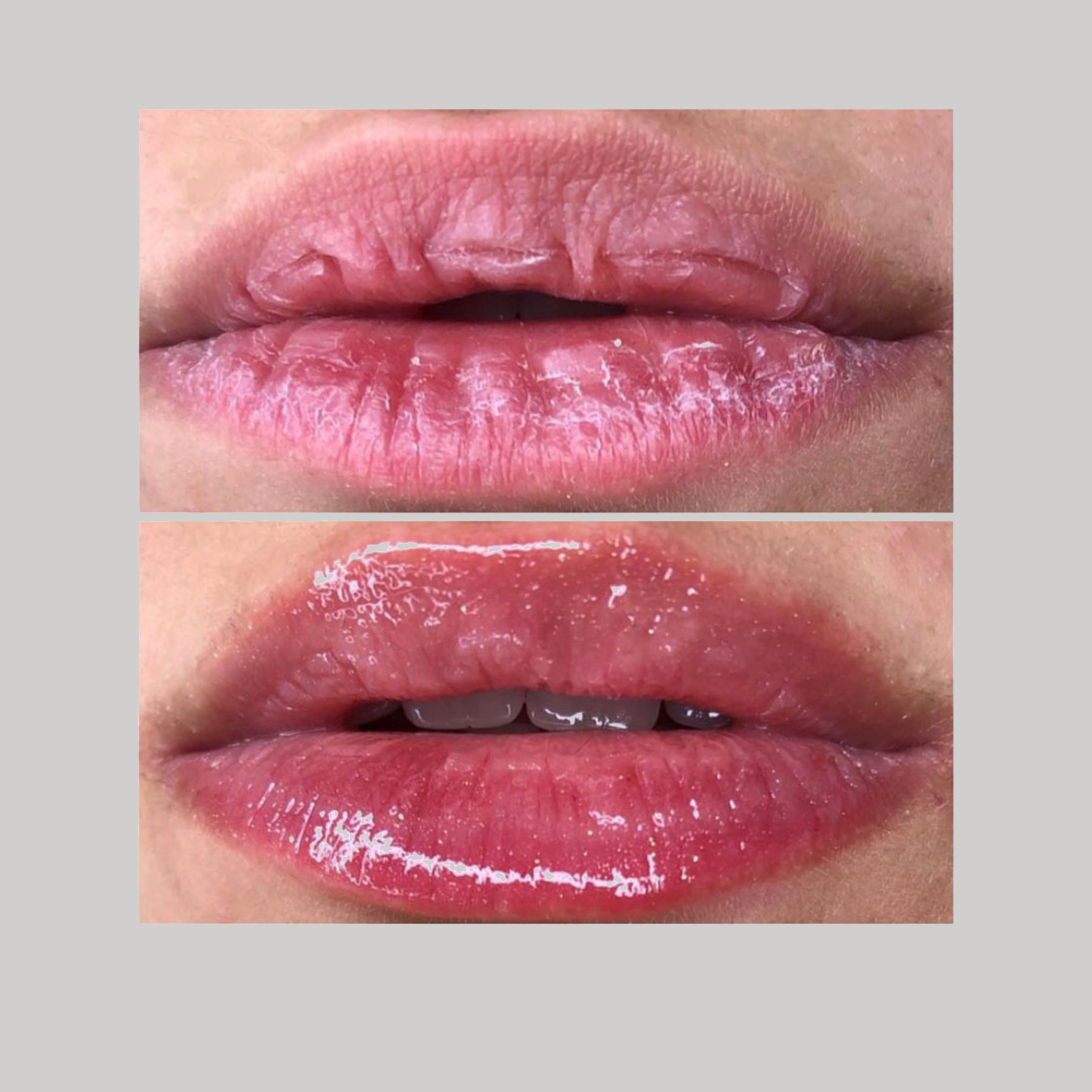 Resultado de Hidratação Labial